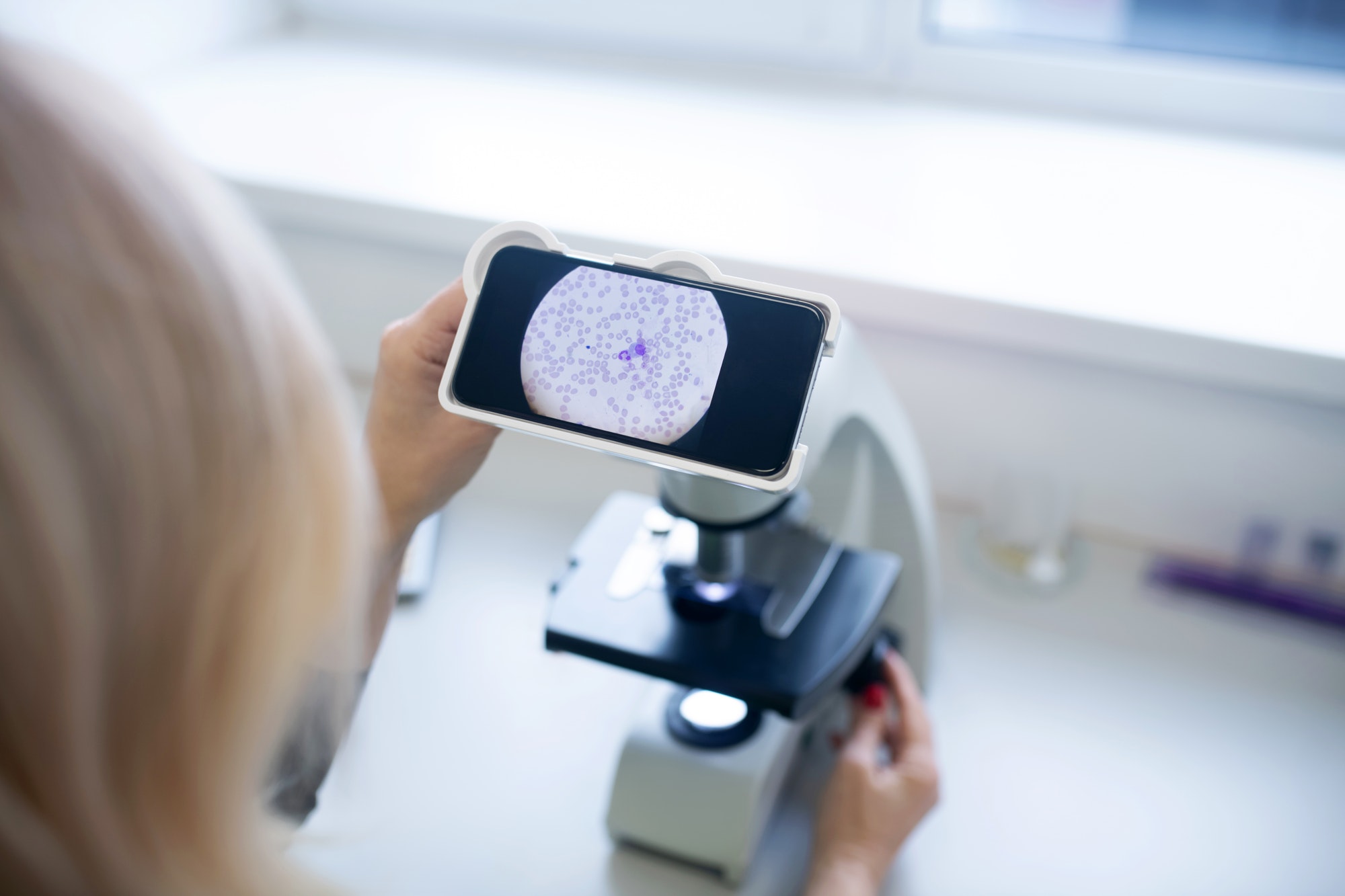 Close up of a test galss with sample for cytological analysis