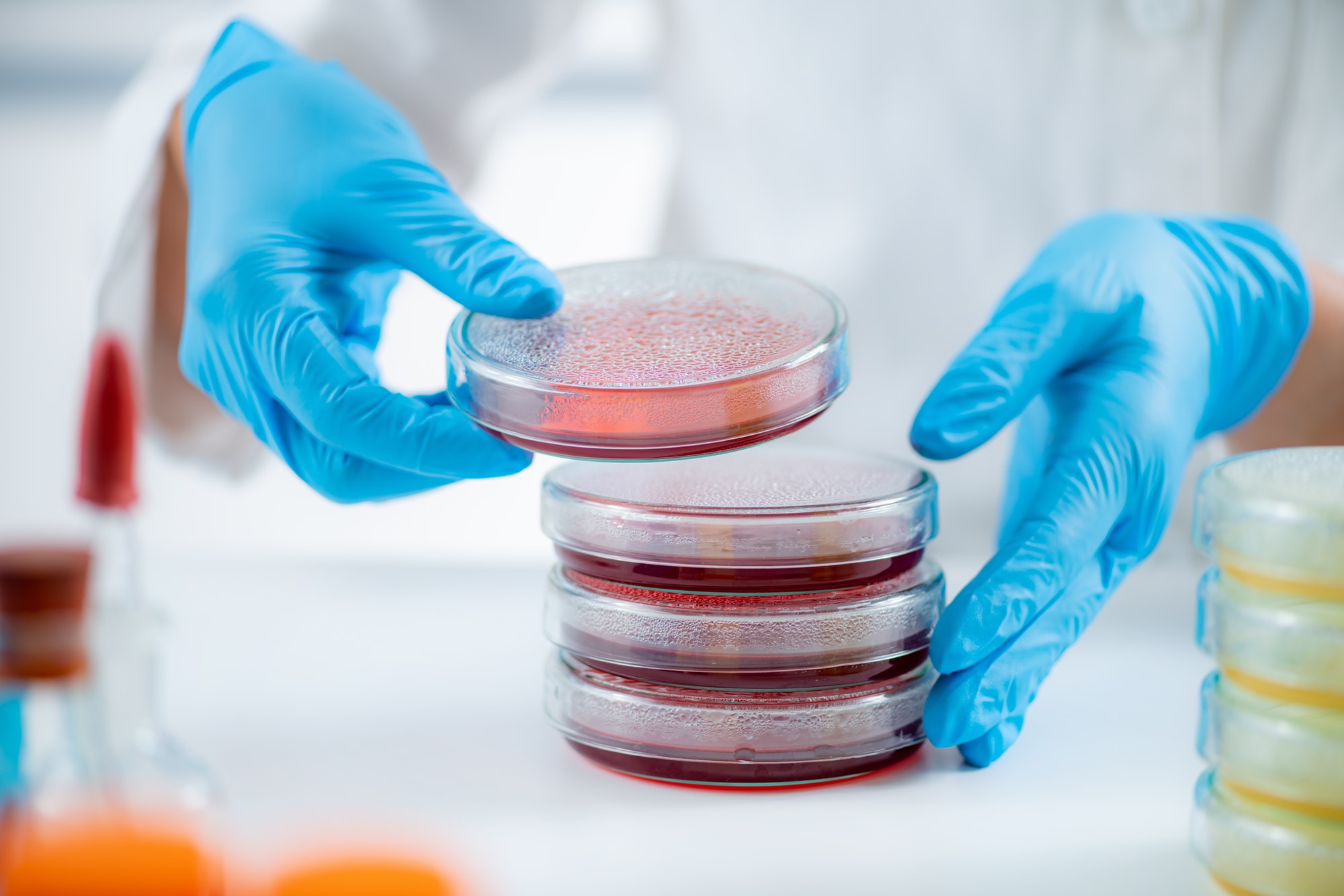 Microbiology bacteria laboratory work.